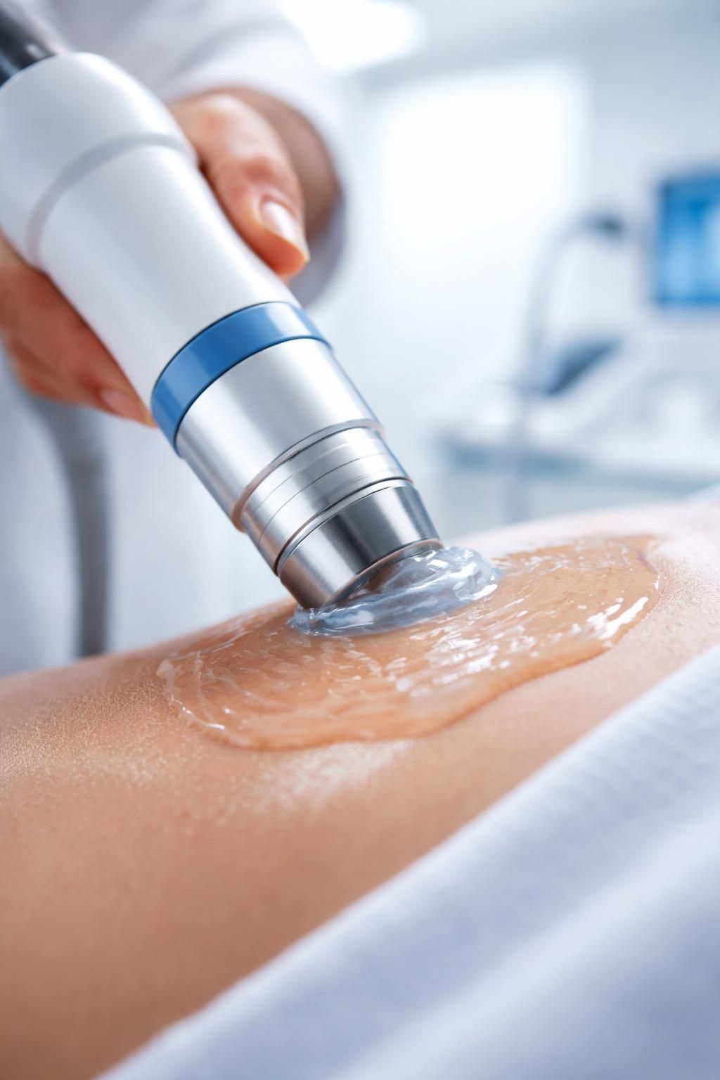 découvrez le traitement par ondes de choc à longueuil pour soulager rapidement et efficacement la calcification tendineuse. solution non invasive pour retrouver mobilité et confort.